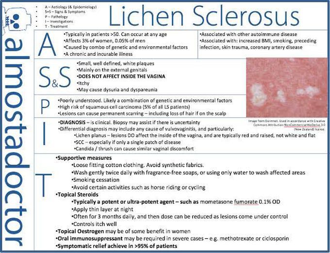 Lichen Sclerosus