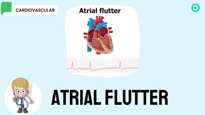 Atrial Flutter: symptoms, ECG features and Treatment options