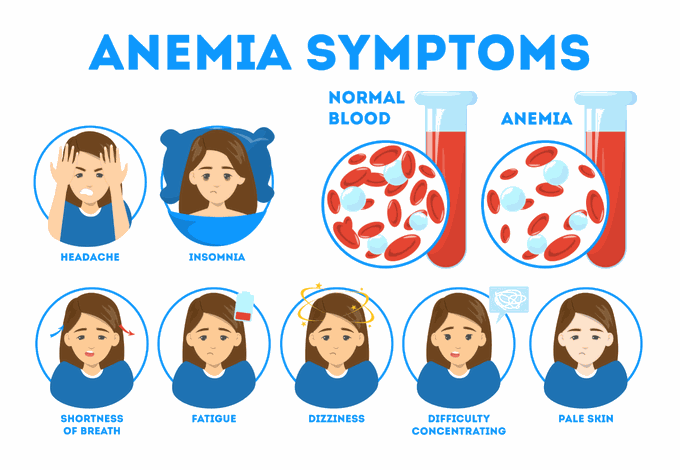 Symptoms of Anemia