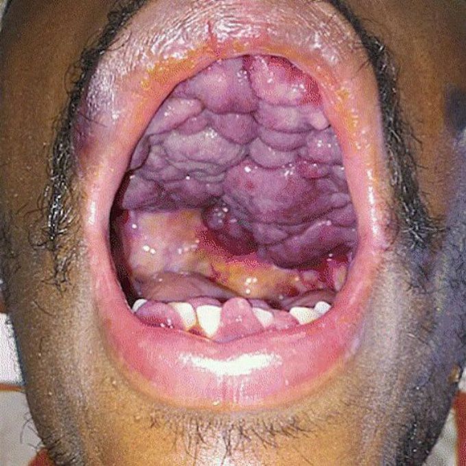 What is the diagnosis???