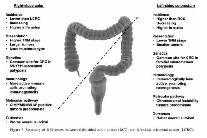 Colorectal Carcinoma