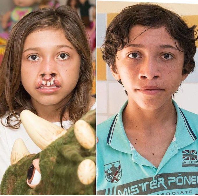 Before and after