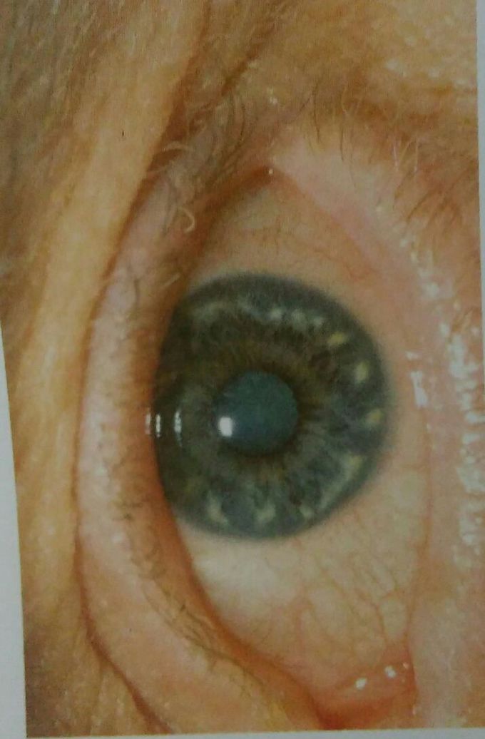 Identify
