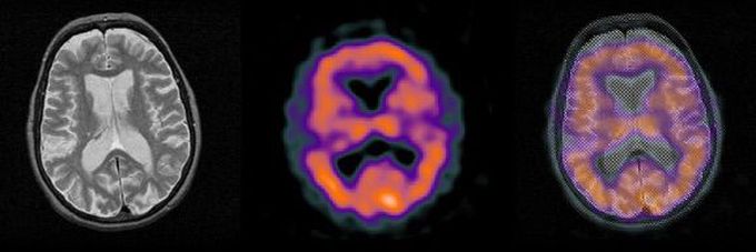 Diagnosis?
