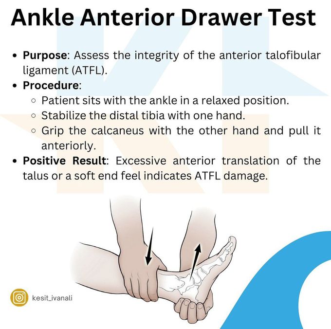 Ankle Anterior Draw Test