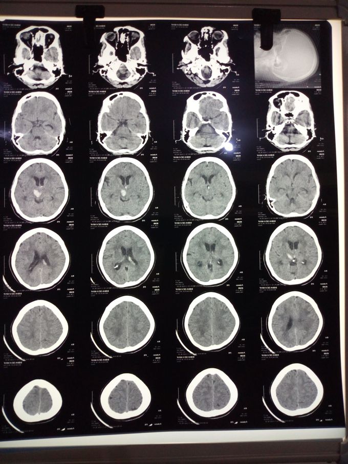 Whats wrong with this ct