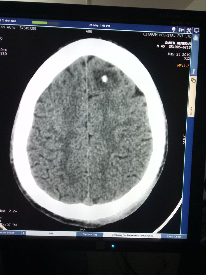 Age 32 yrs.. Male