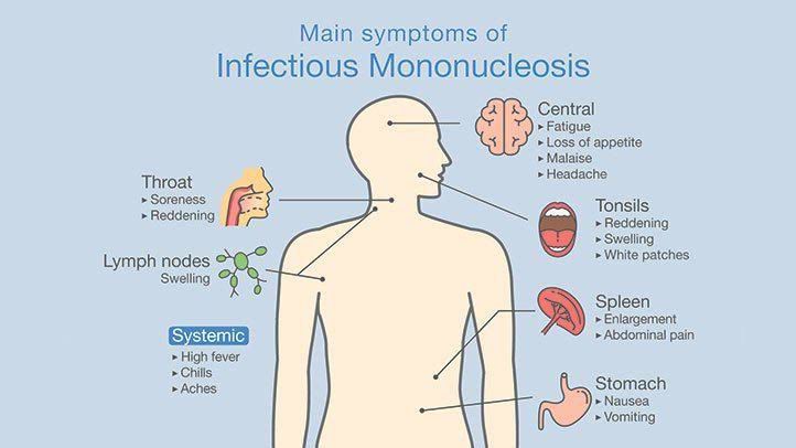 Infectious Mononucleosis - Ask Hematologist