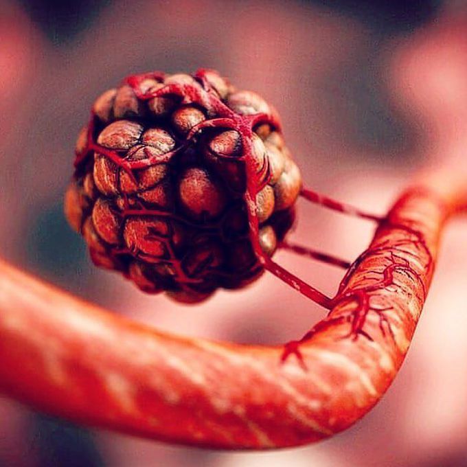 A cancer stealing the victim’s blood supply to supply it’s own growth? That’s what you are looking at!
