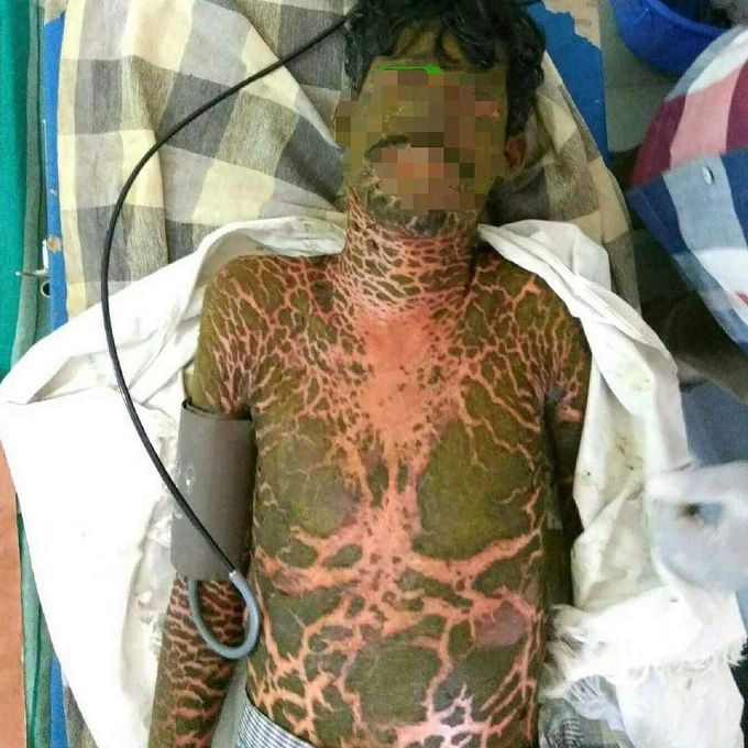 ❌Very strange case❌ 