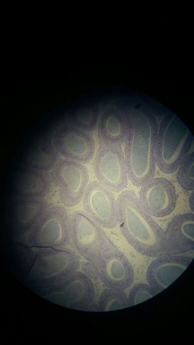 What's the tissue? What's the blue cells?