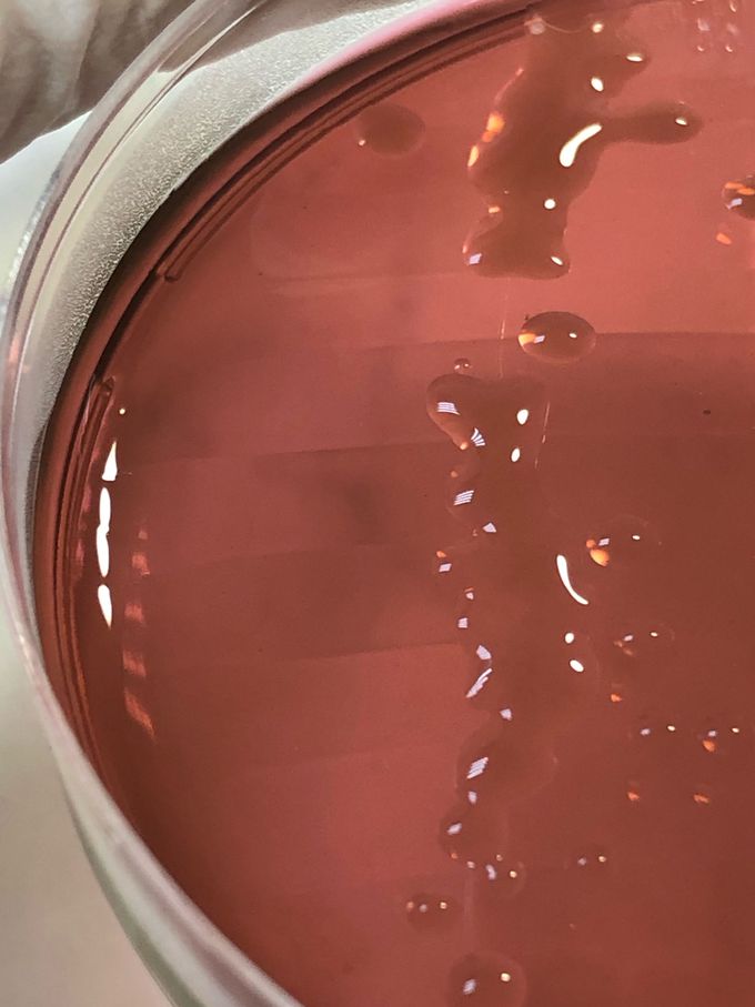82 years old male patient's urine specimen was inoculated to EMB agar. After 24 hours incubation was developed pink, capsulated colonies of Pseudomonas aeruginosa.