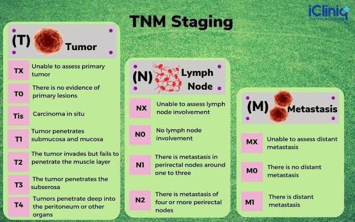 TNM staging of cancer - MEDizzy