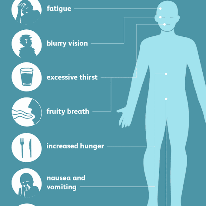 Hyperglycemia