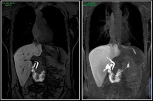 450 FOV @ Siemens 3T Prisma 450 FOV at the hepatobiliary - MEDizzy