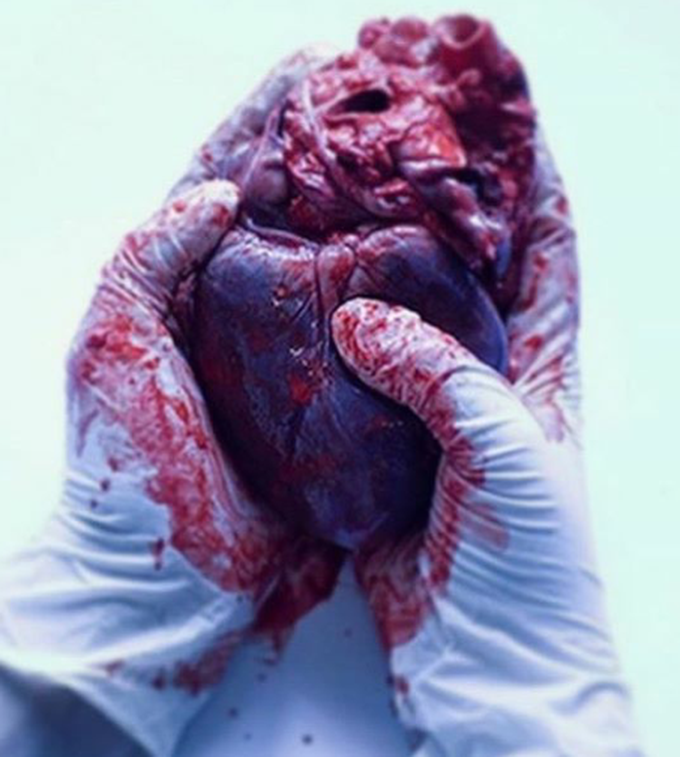 Heart ❤