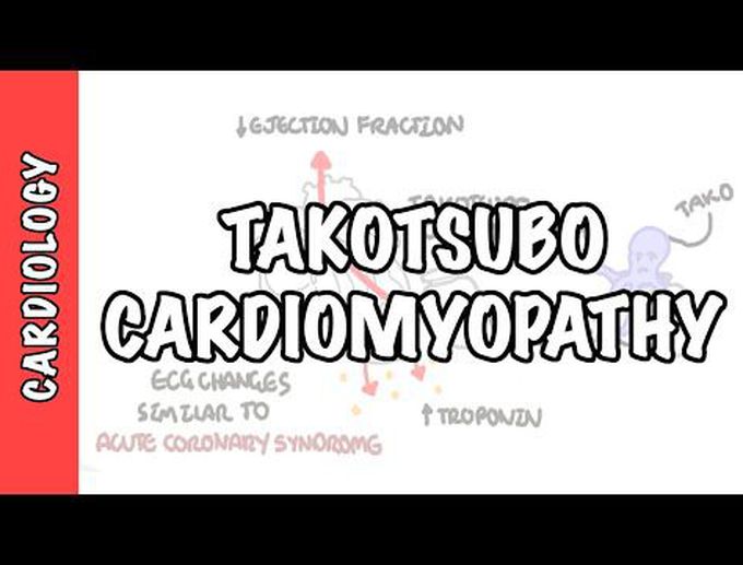 Pathophysiology of Takotsubo cardiomyopathy