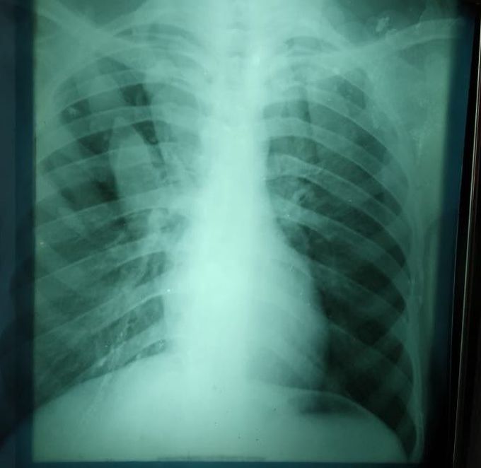 Rediology quiz