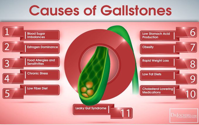 Cause of gall stone