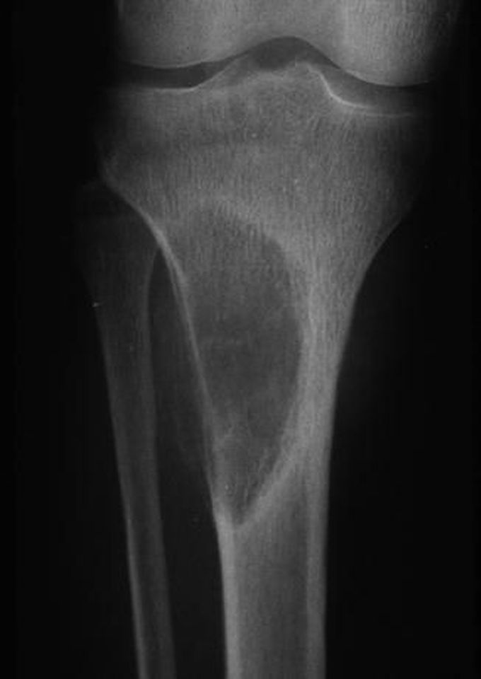 For the critical thinkers ONLY. 🤓 what is your diagnosis