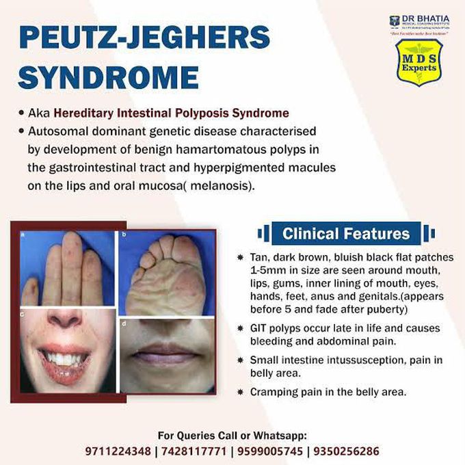 Peutz-Jeghers Syndrome