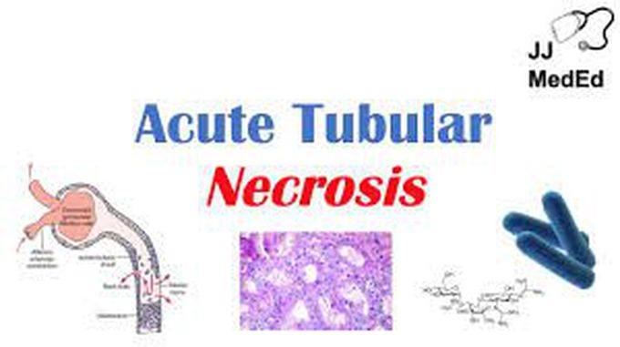 What are the symptoms of acute tubular necrosis?