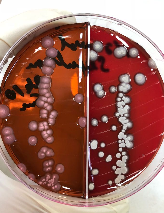 Candida tropicalis