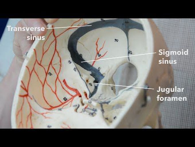 Dural venous sinuses