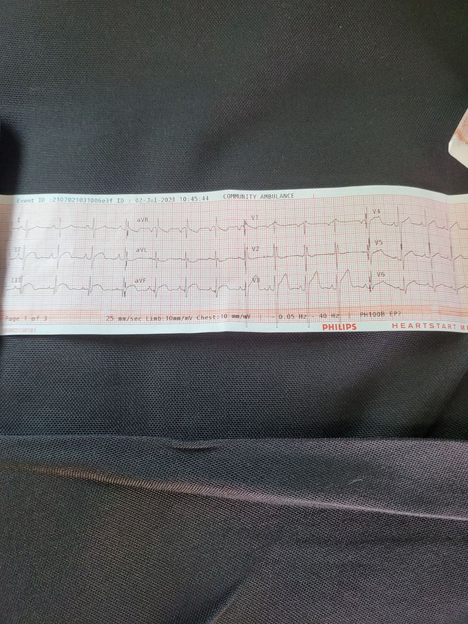 Interesting ekg