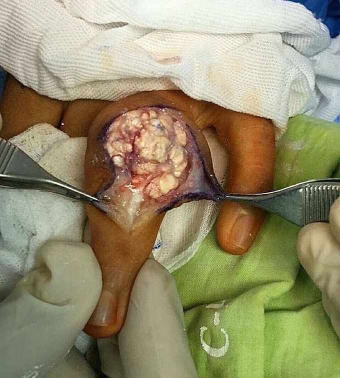 What is your diagnosis ?
