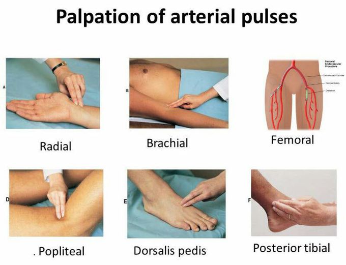 Palpation of arterial pulses