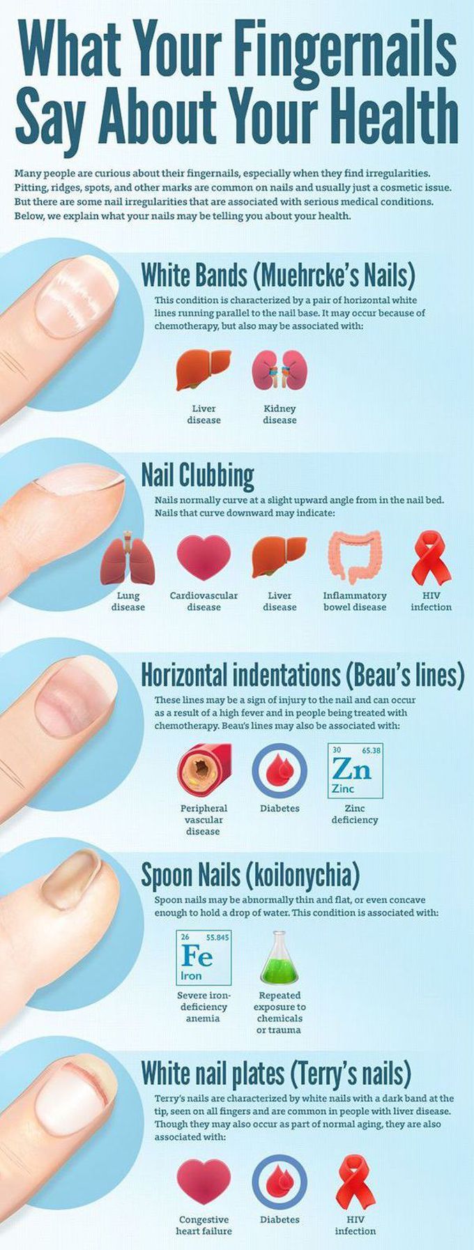 Nails Diagnosis