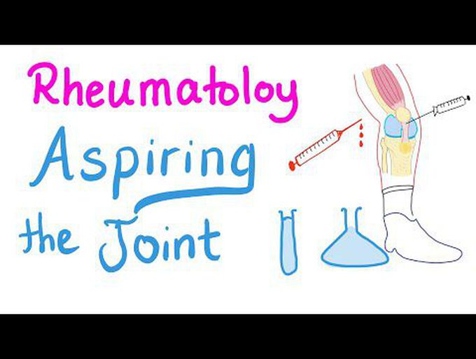 Rheumatology...Joint Fluid Analysis (Physiology)