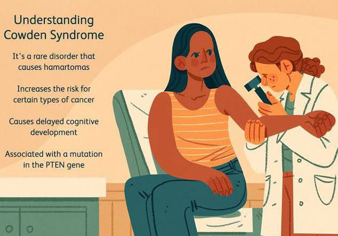 These are some points for understanding Cowden syndrome