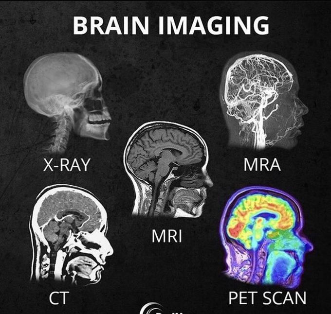 Brain Imaging - MEDizzy