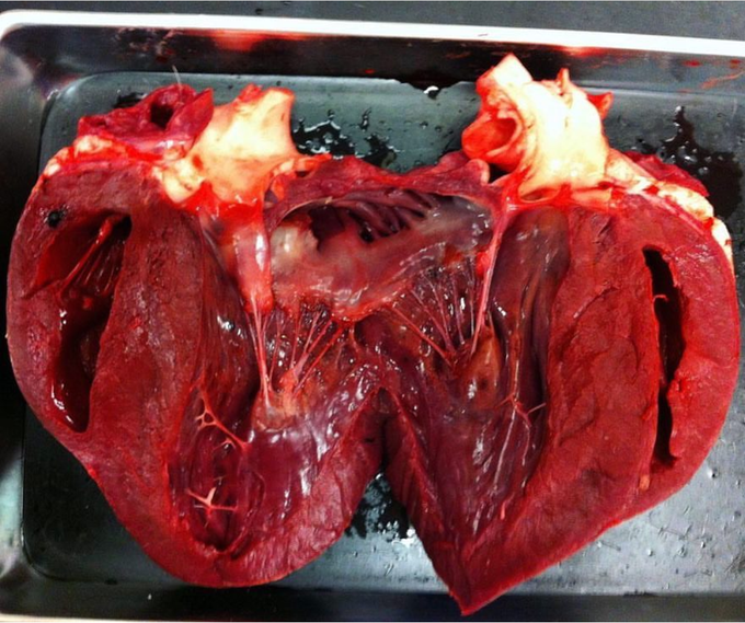 An Amazing Shot Of An Hypertrophic Heart.
