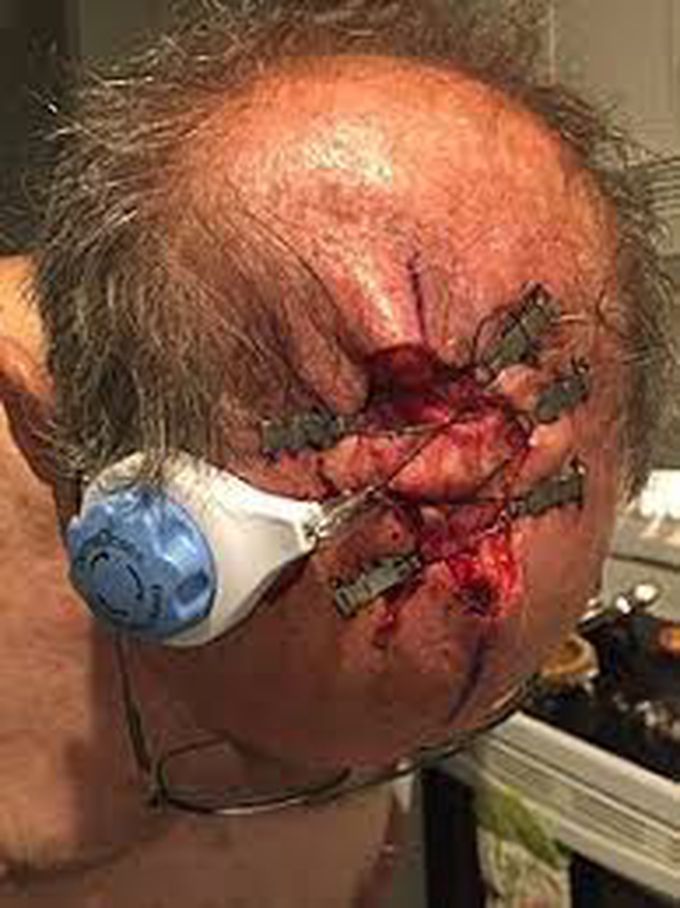 Head injury ,whats the next step you do ?????