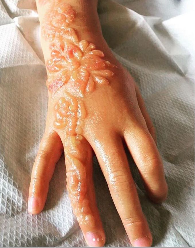 What is your diagnosis??
