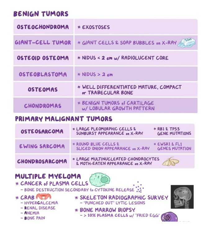 Musculoskeletal disorder