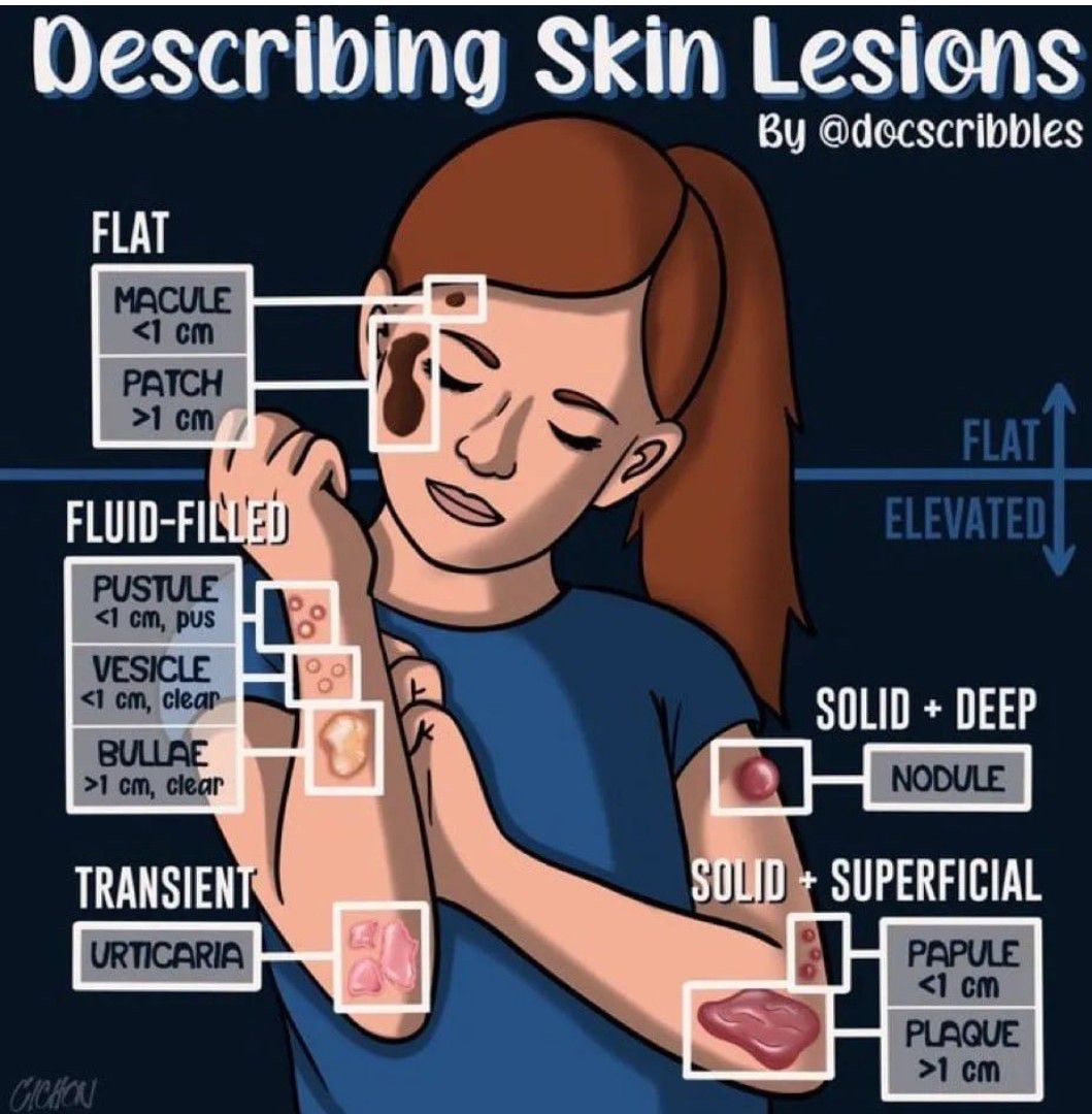 Skin Lesions Medizzy