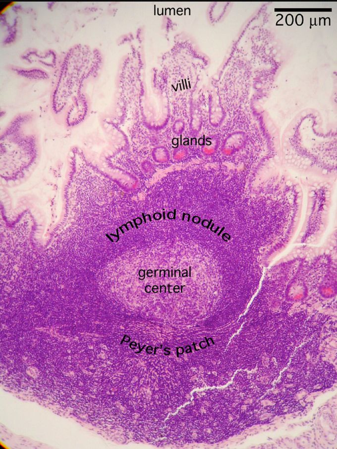 Peyer's patches--one of the lymphatic tissues in our body
