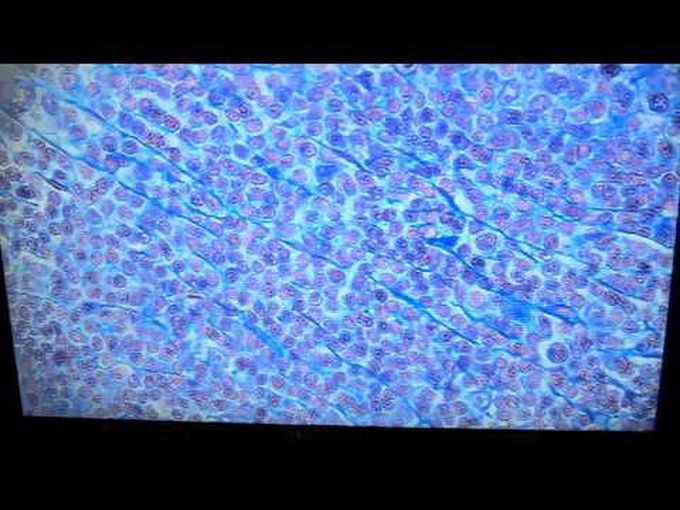 Histology of Reticular Connective tissue