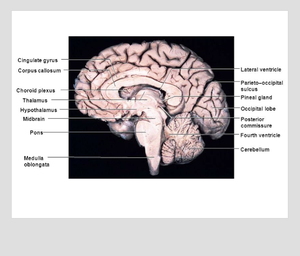Sagittal section of brain - MEDizzy