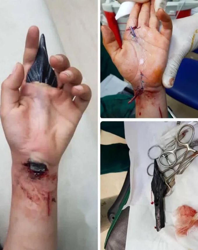 Pierced spearhead through the hand!