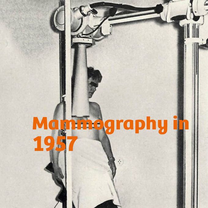 Mammography