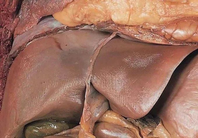 Normal Human Liver - MEDizzy