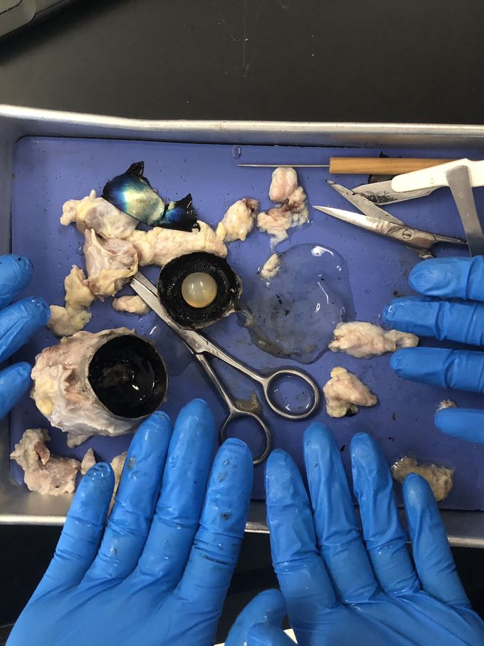 Eye Dissection