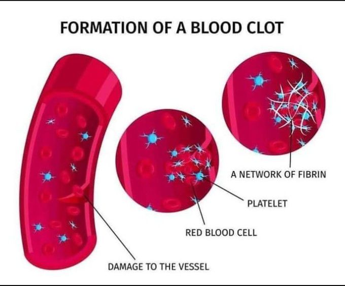 Blood clot formation