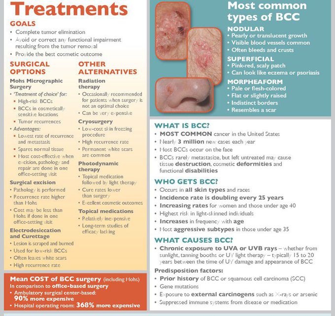 Treatment for basal cell carcinoma