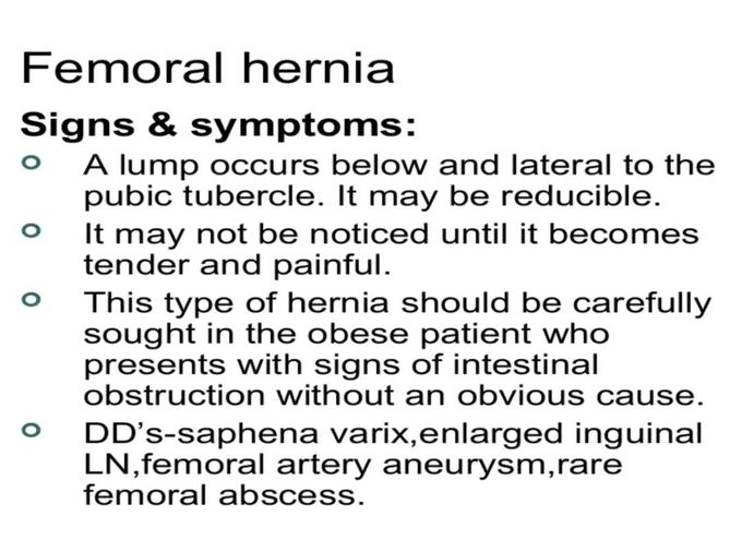 Symptoms of femoral hernia